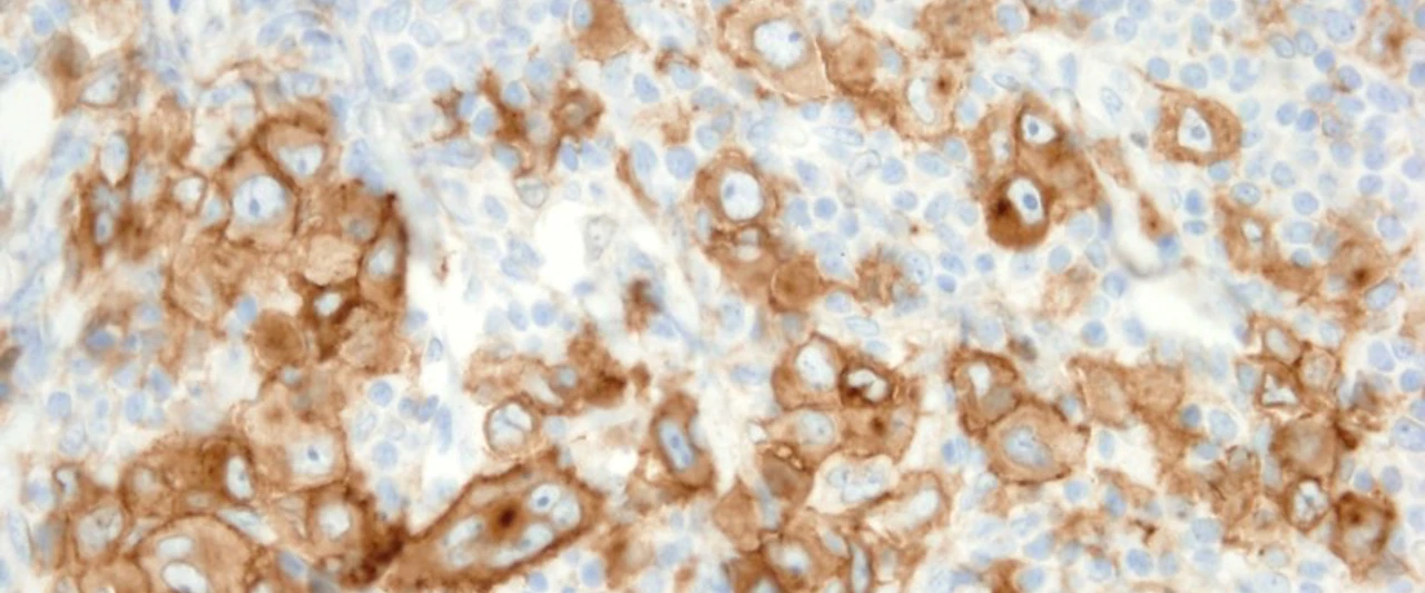 IHC dag 2026 over Lymfomen